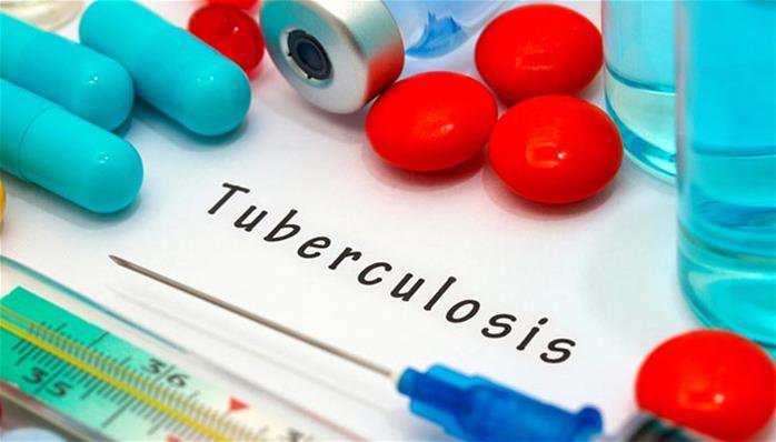 tuberculosis-02-05-2016